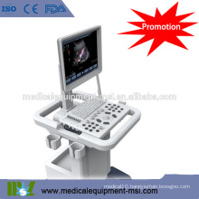 MSLCU27M - ultrasound machine - trolley ultrasound machine, 2015 type